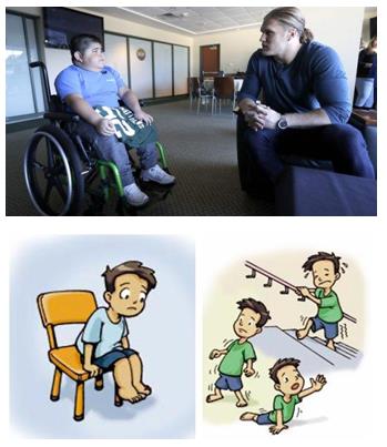 日本藤田醫科大學教授談罕見病DMD 新藥獲批！有望造福DMD患者！